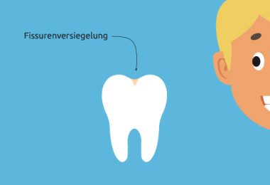 Fissurenversiegelung Kinder Illustration