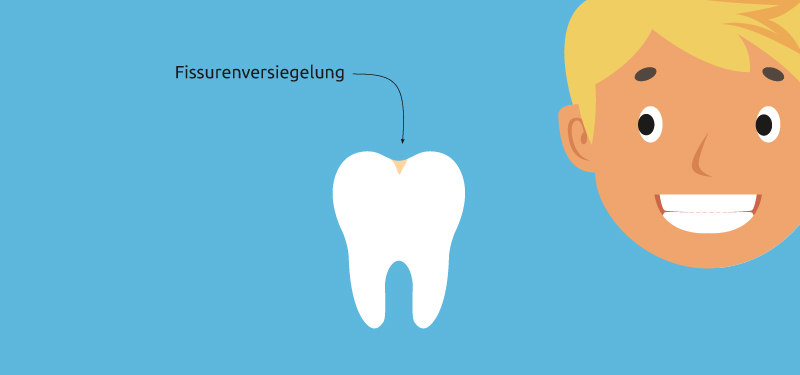 Fissurenversiegelung Kinder Illustration