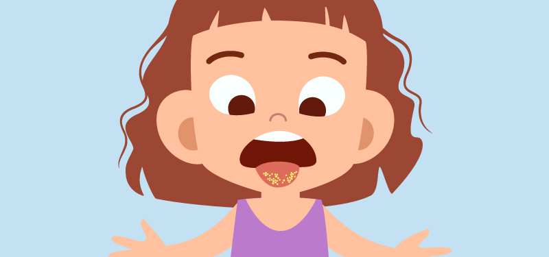 Kind mit Mundfäule Illustration